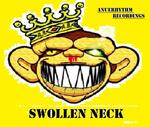 Swollen Neck