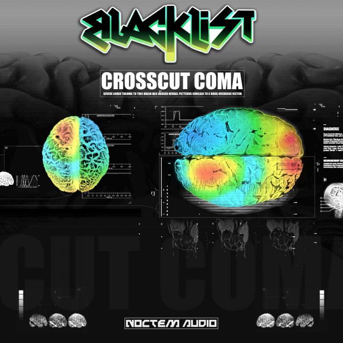 BLACKLIST - CrossCut Coma