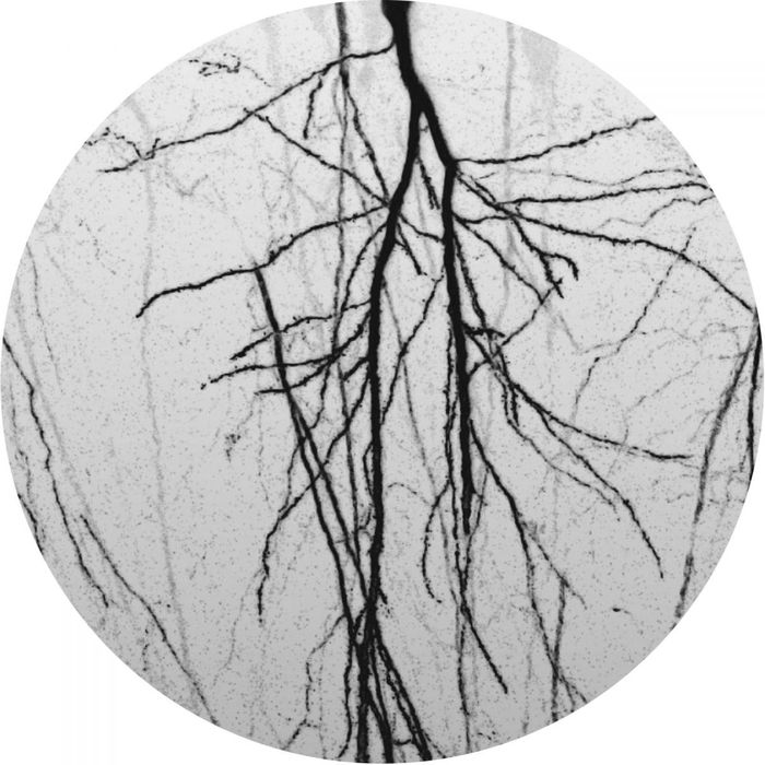 Dodi Palese - Brainscapes EP Dodi Palese - Brainscapes EP