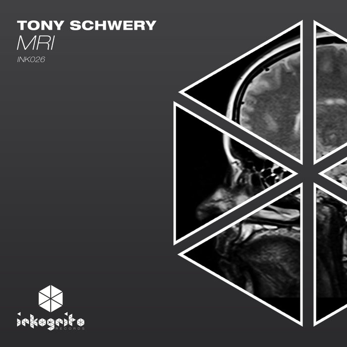 TONY SCHWERY - MRI
